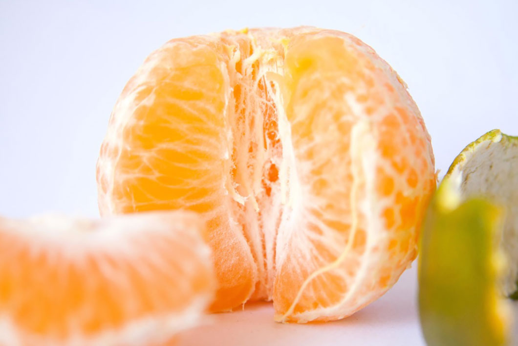 Bienfaits Des Oranges Pour Votre Sant