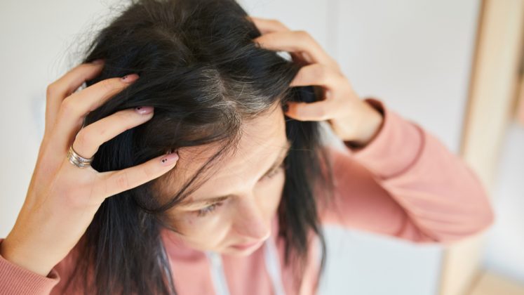 Le Stress Peut Il Rendre Les Cheveux Gris