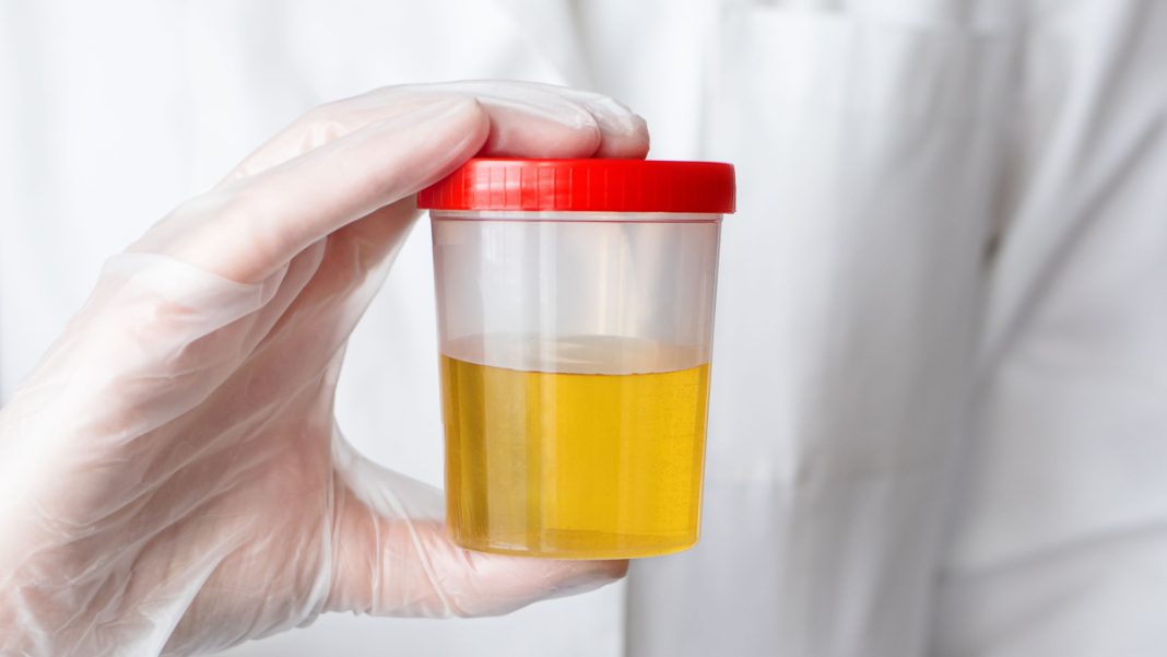 Pourquoi Notre Urine Est Elle Jaune Les Scientifiques Ont Enfin La