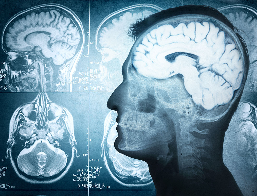 Représention d'un homme de profil et de son activité cérébrale via Shutterstock