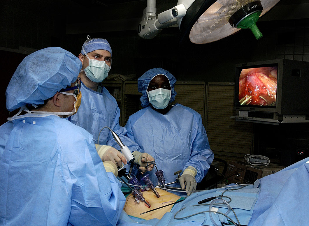Une chirurgie laparoscopique