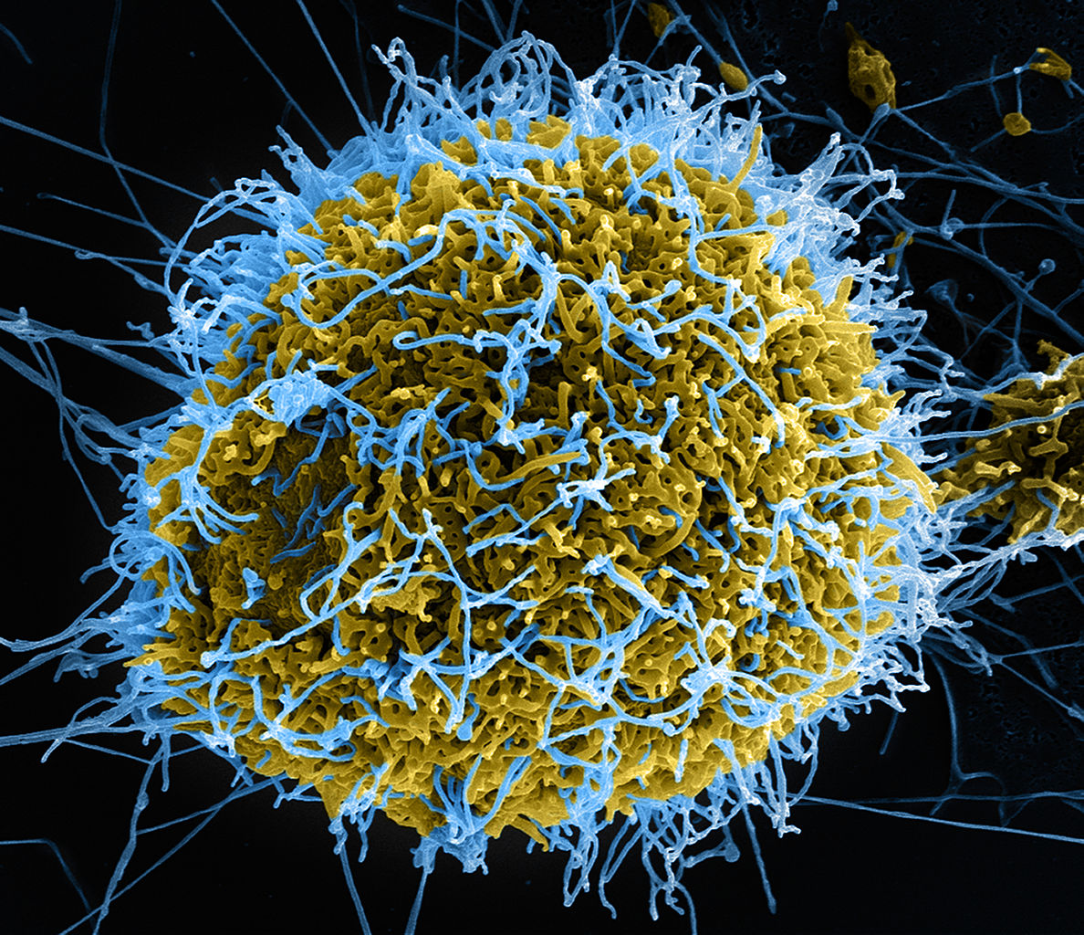 Ebola_Virus_Particles_(7)