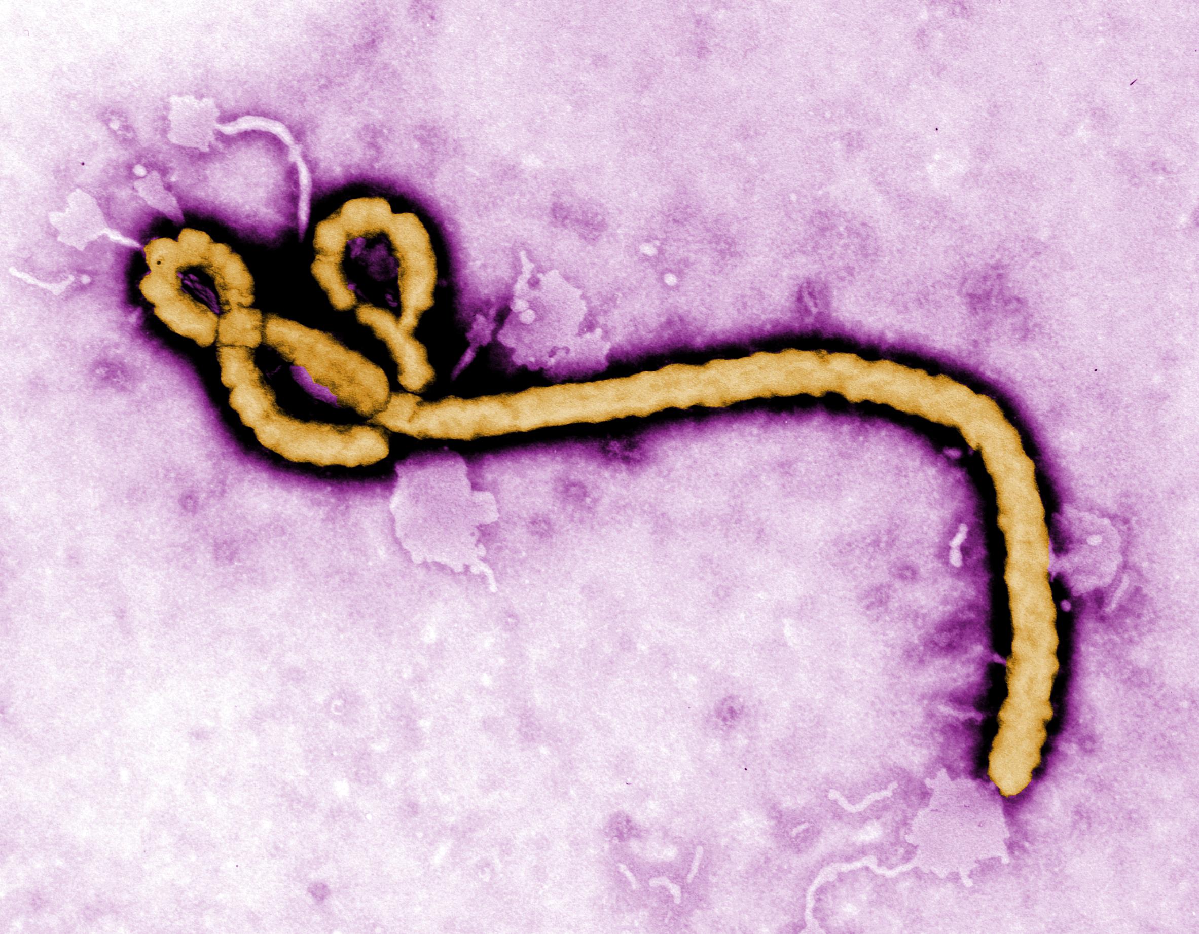 © Cellule souche du Virus Ebola observé au microscope électronique 