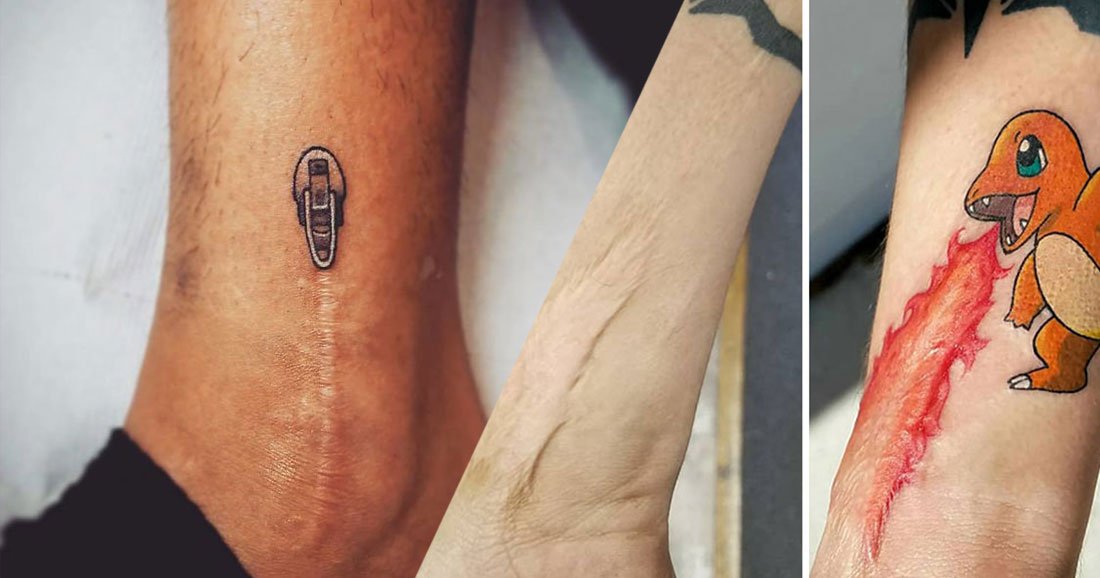 21 idées de tatouages géniales pour camoufler vos cicatrices ...