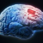 Un implant dans le cerveau