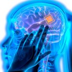 Un implant cérébral