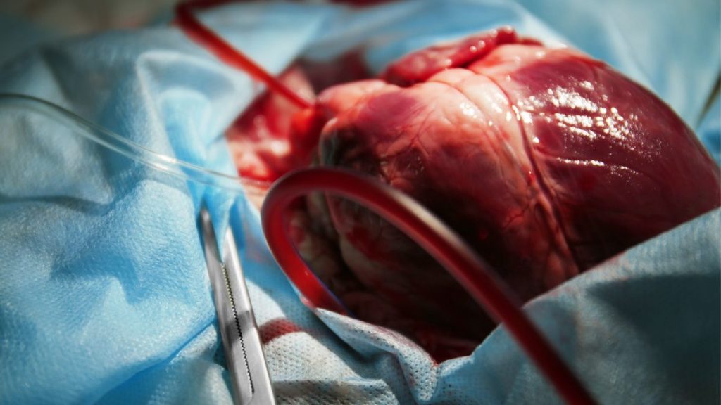 transplantation-organe-coeur