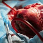 transplantation-organe-coeur