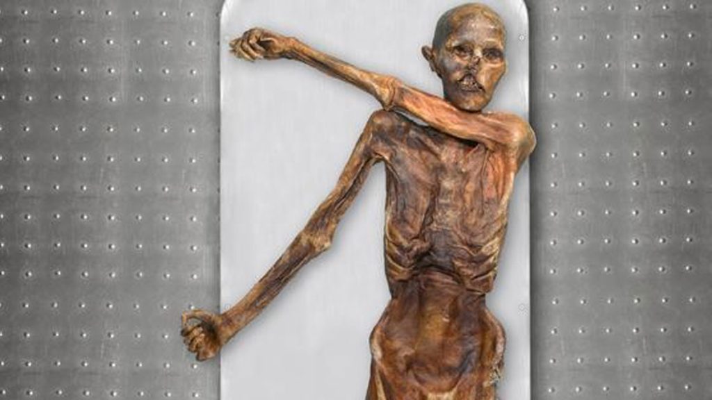Ötzi