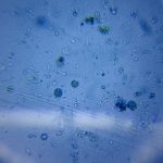 virus-fosse-mariannes