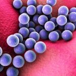 infections-nosocomiales