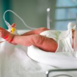 naissance-prematuree