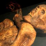 Ötzi