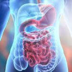 Maladie Intestin