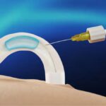 Contraception Masculine