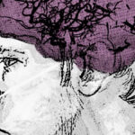 Crâne traversé par un faisceau de protons