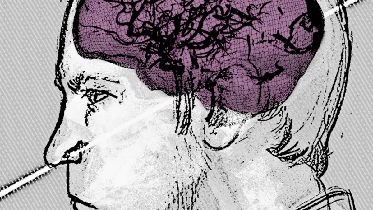 Crâne traversé par un faisceau de protons