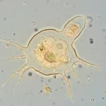 Amibe résistante au chlore et à la chaleur observée au microscope, avec pseudopodes visibles dans un milieu aqueux.