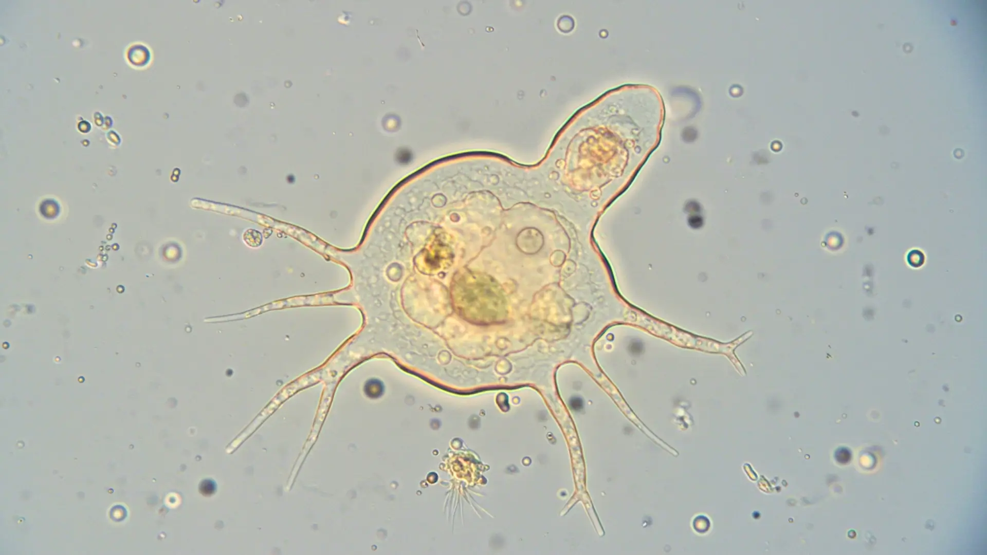 Amibe résistante au chlore et à la chaleur observée au microscope, avec pseudopodes visibles dans un milieu aqueux.