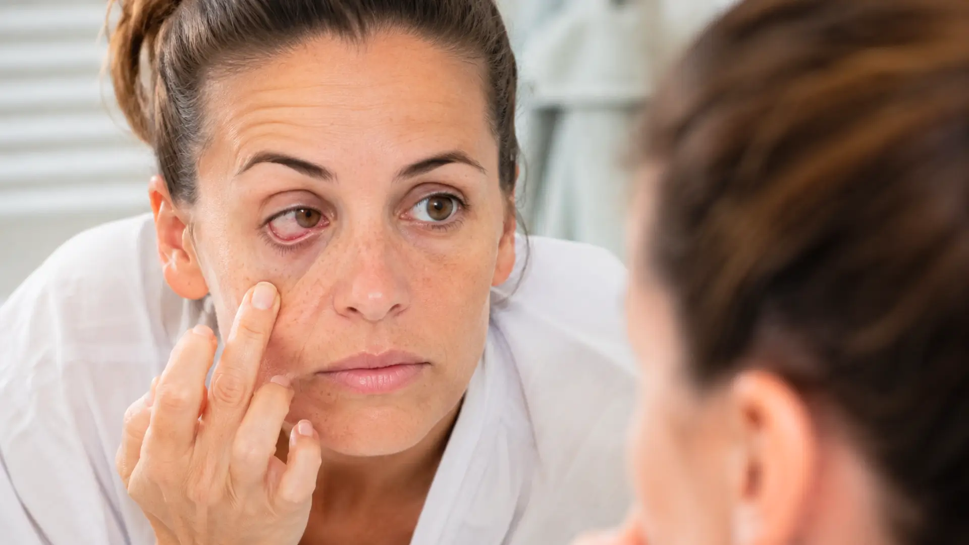 Femme fatiguée examinant une paupière irritée devant un miroir au réveil