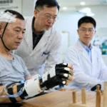 Patient utilisant un gant robotisé contrôlé par une interface cerveau-machine NEO dans un hôpital en Chine, observé par des médecins devant un écran de données neurologiques.