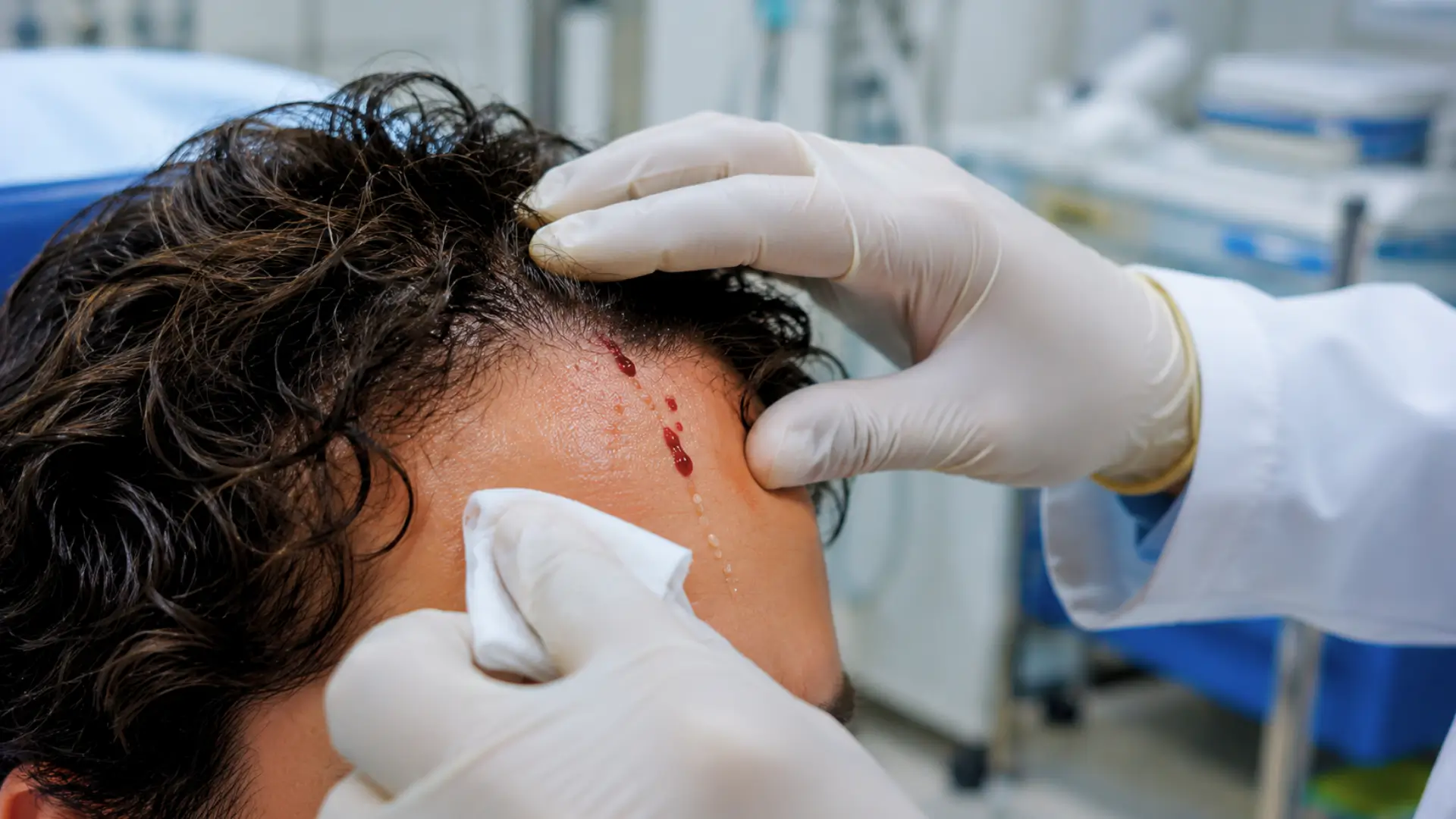 Un professionnel de santé ganté examine le front d’un patient sans visage visible, avec quelques gouttes de sang au niveau de la ligne des cheveux, dans une salle d’hôpital.